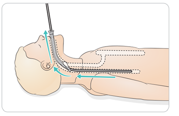 What types of intubation devices and methods does the Resusci Family ...