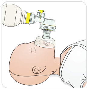 What Types Of Intubation Devices And Methods Does The Resusci Family 